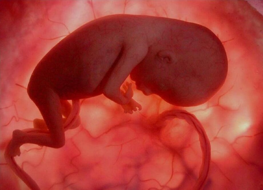 feto 3